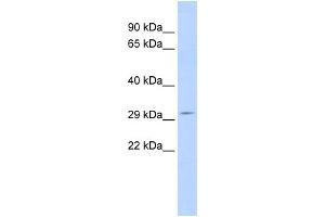 WB Suggested Anti-SCOTIN Antibody Titration:  0. (SHISA5 anticorps  (Middle Region))
