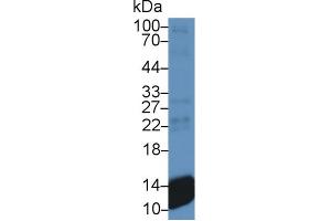 Western Blot; Sample: Human Platelet lysate; Primary Ab: 300 Mouse Anti-Human bTG Antibody Second Ab: 0. (CXCL7 anticorps  (AA 59-128))