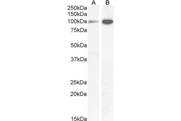 GRIN1/NMDAR1 anticorps  (Internal Region)