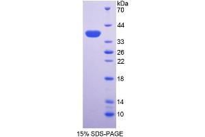 SDS-PAGE analysis of Mouse ALPL Protein.