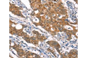 Immunohistochemistry (IHC) image for anti-Cylindromatosis (Turban Tumor Syndrome) (CYLD) antibody (ABIN2432904) (CYLD anticorps)