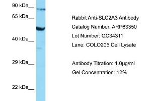 Western Blotting (WB) image for anti-Solute Carrier Family 2 (Facilitated Glucose Transporter), Member 3 (SLC2A3) (Middle Region) antibody (ABIN2789461)