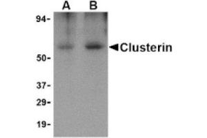 Image no. 1 for anti-Clusterin (CLU) (Isoform 1) antibody (ABIN265125) (Clusterin anticorps  (Isoform 1))
