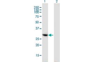 Western Blot analysis of CCDC5 expression in transfected 293T cell line by CCDC5 monoclonal antibody (M01), clone 1E3.