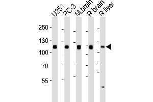 Western blot analysis of lysates from , PC-3 cell line, mouse brain, rat brain and liver tissue lysates (from left to right), using USP5 Antibody (ABIN1944895 and ABIN2838537). (USP5 anticorps)