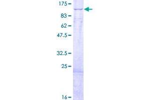 Image no. 1 for Hydroxyacyl-Coenzyme A Dehydrogenase/3-Ketoacyl-Coenzyme A Thiolase/enoyl-Coenzyme A Hydratase (Trifunctional Protein), alpha Subunit (HADHA) (AA 1-763) protein (GST tag) (ABIN1306324)