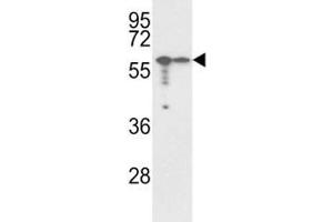 Western blot analysis of VIM antibody and A2058, A375 lysate. (Vimentin anticorps  (AA 152-181))