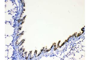 IHC analysis of AGRP using anti-AGRP antibody .
