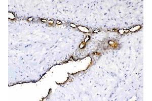 IHC analysis of MUC1 using anti-MUC1 antibody .