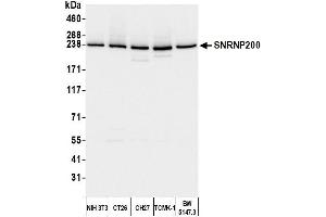 Western Blotting (WB) image for anti-Small Nuclear Ribonucleoprotein 200kDa (U5) (SNRNP200) (AA 400-450) antibody (ABIN7454918)