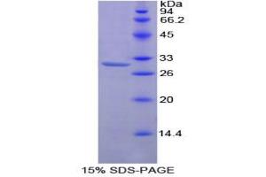 SDS-PAGE analysis of Mouse Protein Kinase C zeta Protein. (PKC zeta Protéine)