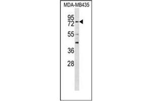 Western blot analysisof RFX3 Antibody (C-term) in MDA-MB435 cell line lysates (35ug/lane).