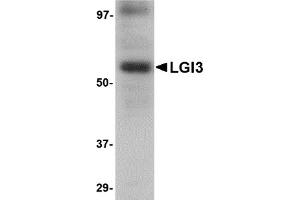 Western Blotting (WB) image for anti-Leucine-Rich Repeat LGI Family, Member 3 (LGI3) (Middle Region) antibody (ABIN1030983) (LGI3 anticorps  (Middle Region))