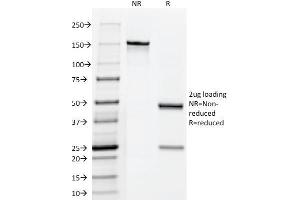 anti-CGA (HCG-Alpha) & CGB (HCG-Beta) antibody