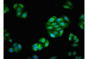 Immunofluorescent analysis of HepG2 cells using ABIN7152590 at dilution of 1:100 and Alexa Fluor 488-congugated AffiniPure Goat Anti-Rabbit IgG(H+L)