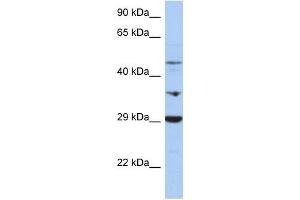 PDK3 antibody used at 1 ug/ml to detect target protein. (PDK3 anticorps  (Middle Region))
