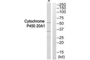 Western blot analysis of extracts from Jurkat cells, using Cytochrome P450 20A1 antibody. (Cytochrome P450, Family 2, Subfamily A, Polypeptide 1 (CYP2A1) anticorps)