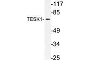 Western blot (WB) analysis of TESK1 antibody in extracts from rat liver cells. (TESK1 anticorps)