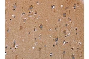 The image on the left is immunohistochemistry of paraffin-embedded Human brain tissue using ABIN7191717(NRG3 Antibody) at dilution 1/30, on the right is treated with synthetic peptide.