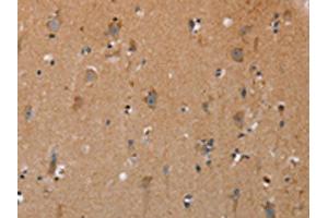 The image on the left is immunohistochemistry of paraffin-embedded Human brain tissue using ABIN7191717(NRG3 Antibody) at dilution 1/30, on the right is treated with synthetic peptide. (Neuregulin 3 anticorps)
