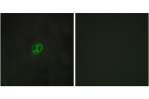 Immunofluorescence analysis of MCF-7 cells, using CRHR1 antibody. (CRHR1 anticorps  (Internal Region))