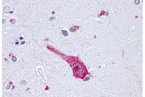 Anti-OPRM1 / Mu Opioid Receptor antibody  ABIN1049171 IHC staining of human brain, neuron. (Mu Opioid Receptor 1 anticorps  (C-Term))