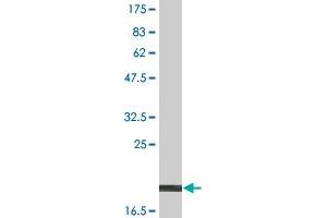 Western Blot detection against Immunogen (19.