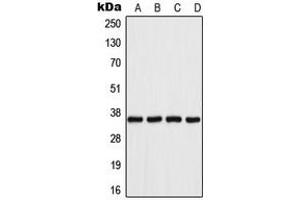 Western blot analysis of Aldose Reductase expression in Jurkat (A), HeLa (B), SP2/0 (C), PC12 (D) whole cell lysates. (AKR1B1 anticorps  (C-Term))