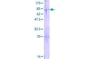 Image no. 1 for Hydroxyacyl-CoA Dehydrogenase/3-Ketoacyl-CoA Thiolase/enoyl-CoA Hydratase (Trifunctional Protein), beta Subunit (HADHB) (AA 1-474) protein (GST tag) (ABIN1306325)