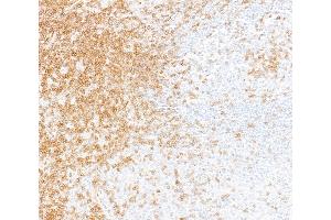 Immunohistochemistry (IHC) image for anti-CD247 Molecule (CD247) (C-Term) antibody (ABIN7455240)