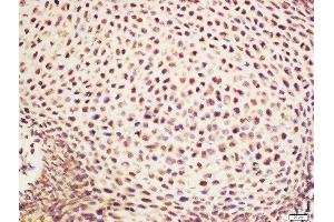 anti-NADH Dehydrogenase (Ubiquinone) 1 alpha Subcomplex, 1, 7.5kDa (NDUFA1) (AA 31-70) antibody