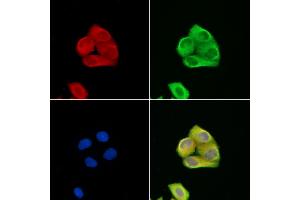 ABIN6257458 and ABIN6274126 staining Hela cells by IF/ICC.