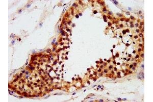 IHC image of ABIN7151284 diluted at 1:600 and staining in paraffin-embedded human testis tissue performed on a Leica BondTM system. (TRIM71 anticorps  (AA 125-209))