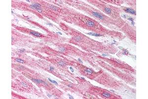 Anti-CRIP2 antibody IHC of human heart.