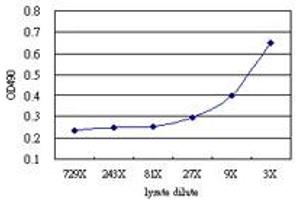 ESD (Human) Matched Antibody Pair
