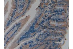 DAB staining on IHC-P; Samples: Rat Intestine Tissue (PKM2 anticorps  (AA 324-531))