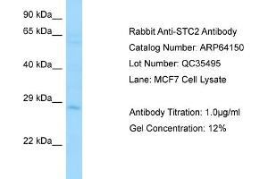 Western Blotting (WB) image for anti-Stanniocalcin 2 (STC2) (C-Term) antibody (ABIN2789749) (Stanniocalcin 2 anticorps  (C-Term))
