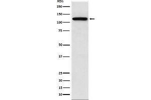 Western blot analysis of Sortilin expression in SW480 cell lysate.