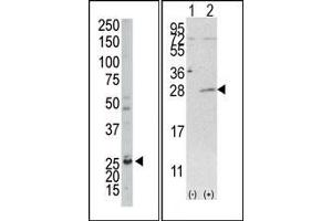 Image no. 1 for anti-Adenylate Kinase 4 (AK4) (C-Term) antibody (ABIN360619) (AK4 anticorps  (C-Term))