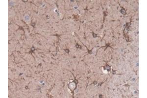 Detection of GFAP in Rat Cerebrum Tissue using Polyclonal Antibody to Glial Fibrillary Acidic Protein (GFAP)