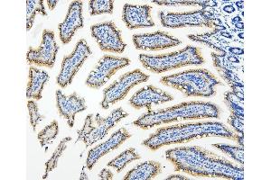IHC analysis of HDAC5 using anti-HDAC5 antibody (ABIN7599922). (HDAC5 anticorps  (AA 13-1107))