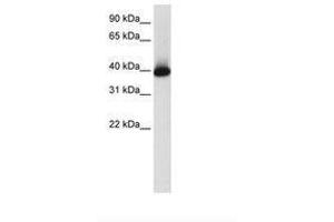 Image no. 1 for anti-GS Homeobox 2 (GSX2) (AA 214-263) antibody (ABIN203048) (GSX2 anticorps  (AA 214-263))