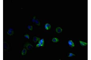Immunofluorescent analysis of MCF-7 cells using ABIN7173107 at dilution of 1:100 and Alexa Fluor 488-congugated AffiniPure Goat Anti-Rabbit IgG(H+L) (TMEM184B anticorps  (AA 311-407))