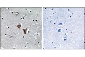 Immunohistochemistry analysis of paraffin-embedded human brain, using WASF4 Antibody. (WASF4 anticorps  (AA 190-239))