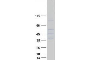 Validation with Western Blot