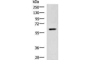 Western blot analysis of A549 cell lysate using TERF1 Polyclonal Antibody at dilution of 1:400 (TRF1 anticorps)
