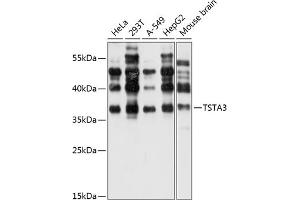 Western blot analysis of extracts of various cell lines, using TST antibody (ABIN6127523, ABIN6149663, ABIN6149664 and ABIN6220526) at 1:1000 dilution. (TSTA3 anticorps  (AA 1-321))
