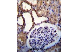 WNK3(PRKWNK3) Antibody immunohistochemistry analysis in formalin fixed and paraffin embedded human kidney tissue followed by peroxidase conjugation of the secondary antibody and DAB staining. (WNK3 anticorps  (C-Term))