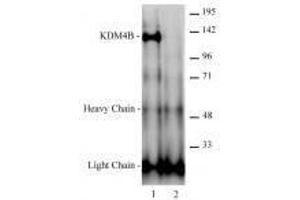 JMJD2B / KDM4B antibody (rAb) tested antibody tested by immunoprecipitation. (Recombinant KDM4B anticorps)
