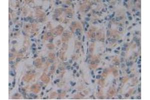 Detection of NOSTRIN in Human Stomach Tissue using Polyclonal Antibody to Nitric Oxide Synthase Trafficker (NOSTRIN) (NOSTRIN anticorps  (AA 18-251))